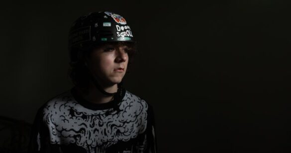 Edmonton Teen Injured