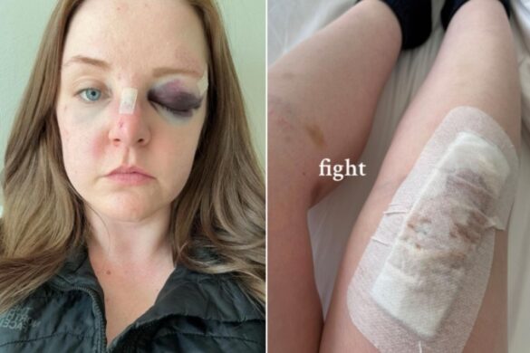 Vancouver Man Assaulting Toronto Tourist