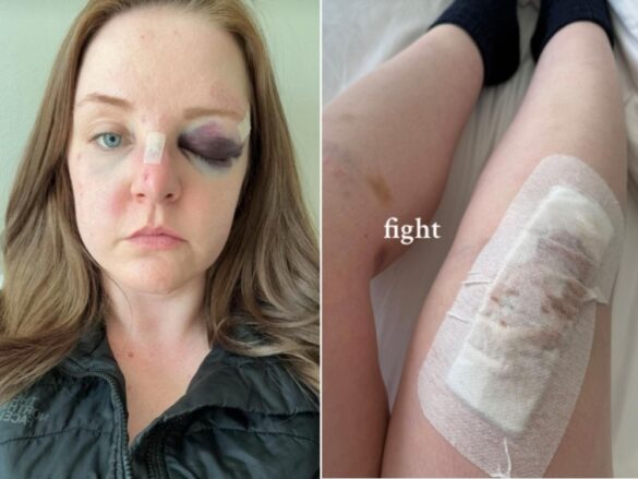 Vancouver Man Assaulting Toronto Tourist